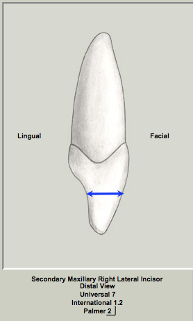 Ext Morph Mx Lateral Distal 2.png
